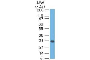 Image no. 1 for anti-BCL2-Like 1 (BCL2L1) (AA 3-14) antibody (ABIN6175399) (BCL2L1 抗体  (AA 3-14))