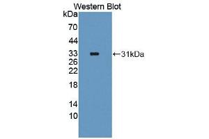 Western blot analysis of the recombinant protein. (FOXO1 抗体  (AA 333-557))