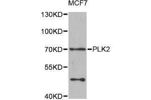 Western blot analysis of extracts of MCF7 cells, using PLK2 antibody. (PLK2 抗体)