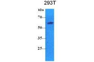 The cell lysates (40 ug) were resolved by SDS-PAGE, transferred to PVDF membrane and probed with anti-human PKLR antibody (1:500). (PKLR 抗体  (AA 47-574))