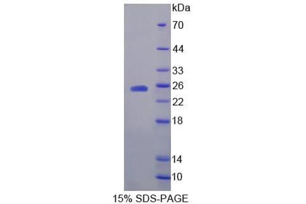 Hippocalcin Protein (HPCA)