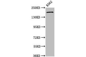 Western Blot Positive WB detected in: K562 whole cell lysate All lanes: PSME4 antibody at 4. (PSME4 抗体  (AA 105-198))