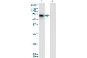 Western Blot analysis of CD44 expression in transfected 293T cell line by CD44 monoclonal antibody (M03), clone 1E1. (CD44 抗体  (AA 1-699))