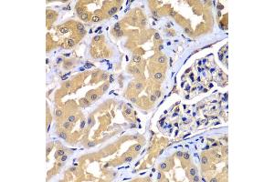 Immunohistochemistry of paraffin-embedded human kidney using WIPI2 antibody (ABIN5975599) at dilution of 1/100 (40x lens). (WIPI2 抗体)