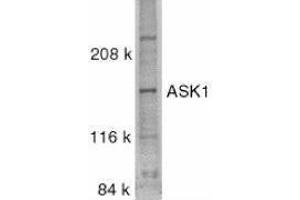 Western Blotting (WB) image for anti-Mitogen-Activated Protein Kinase Kinase Kinase 5 (MAP3K5) (C-Term) antibody (ABIN2477505) (ASK1 抗体  (C-Term))