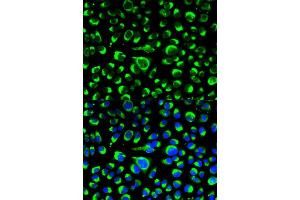 Immunofluorescence analysis of HeLa cell using P4HB antibody. (P4HB 抗体  (AA 329-508))