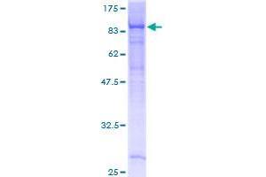 Image no. 1 for EH-Domain Containing 4 (EHD4) (AA 1-541) protein (GST tag) (ABIN1352467) (EHD4 Protein (AA 1-541) (GST tag))