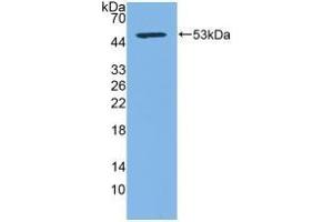 Detection of Recombinant CD83, Human using Polyclonal Antibody to Cluster Of Differentiation 83 (CD83) (CD83 抗体  (AA 24-205))