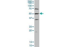 CDC14B polyclonal antibody (A01), Lot # 06046. (CDC14B 抗体  (AA 360-459))