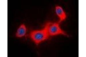 Immunofluorescent analysis of IRS1 staining in HeLa cells. (IRS1 抗体)