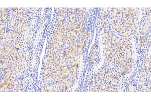 Detection of DDC in Human Kidney Tissue using Polyclonal Antibody to Dopa Decarboxylase (DDC) (DDC 抗体  (AA 200-420))