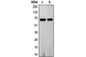 Western blot analysis of Frizzled 5 expression in PC3 (A), LOVO (B) whole cell lysates. (FZD5 抗体  (C-Term))