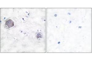Immunohistochemistry analysis of paraffin-embedded human brain tissue, using Notch 1 (Cleaved-Val1754) Antibody. (Notch1 抗体  (Cleaved-Val1754))