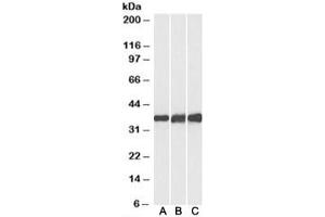 Western blot testing of human [A], mouse [B] and rat [C] heart lysates with Lactate Dehydrogenase B antibody at 0. (LDHB 抗体)