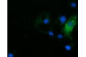 Anti-HDAC6 mouse monoclonal antibody (ABIN2453117) immunofluorescent staining of COS7 cells transiently transfected by pCMV6-ENTRY HDAC6 (RC209649). (HDAC6 抗体)