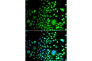 Immunofluorescence analysis of A549 cells using PAX6 antibody (ABIN5975500). (PAX6 抗体)
