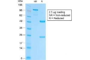 SDS-PAGE (SDS) image for anti-Epithelial Cell Adhesion Molecule (EPCAM) (AA 100-224), (Extracellular Domain) antibody (ABIN6939996)