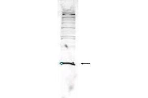 Western blot analysis is shown using  Affinity Purified anti-Human PARK7 antibody to detect PARK7 present in Jurkat whole cell lysate. (PARK7/DJ1 抗体  (AA 177-189))