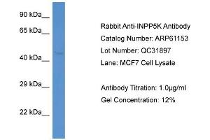 Western Blotting (WB) image for anti-Inositol Polyphosphate-5-Phosphatase K (INPP5K) (N-Term) antibody (ABIN970963) (INPP5K 抗体  (N-Term))