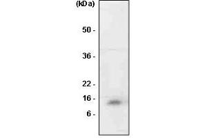 Western Blotting (WB) image for anti-Macrophage Migration Inhibitory Factor (Glycosylation-Inhibiting Factor) (MIF) antibody (ABIN165432) (MIF 抗体)