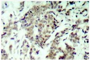 Image no. 2 for anti-Tumor Protein P53 (TP53) antibody (ABIN271765) (p53 抗体)