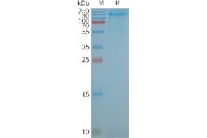 Human -Nanodisc, Flag Tag on SDS-PAGE (LGR4 蛋白)