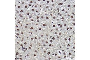 Immunohistochemistry of paraffin-embedded rat liver using PDCD7 Rabbit mAb (ABIN3022039, ABIN3022040, ABIN3022041, ABIN1513274 and ABIN1514421) at dilution of 1:100 (40x lens). (PDCD7 抗体)