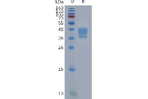 Human F2RL1 Protein, hFc Tag on SDS-PAGE under reducing condition. (F2RL1 Protein (AA 37-71) (Fc Tag))
