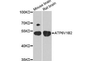 Western Blotting (WB) image for anti-ATPase, H+ Transporting, Lysosomal 56/58kDa, V1 Subunit B2 (ATP6V1B2) (AA 262-511) antibody (ABIN6220345) (ATP6V1B2 抗体  (AA 262-511))