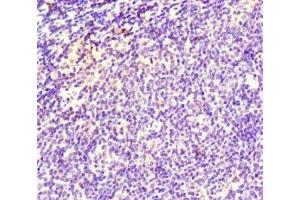 Immunohistochemistry of paraffin-embedded human lymph node tissue using ABIN7171353 at dilution of 1:100 (TCL1A 抗体  (AA 1-90))