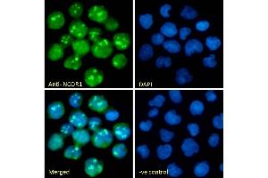 (ABIN7505820) Immunofluorescence analysis of paraformaldehyde fixed Jurkat cells, permeabilized with 0. (NCOR1 抗体)