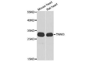 Western blot analysis of extracts of various cell lines, using TNNI3 antibody. (TNNI3 抗体  (AA 1-210))