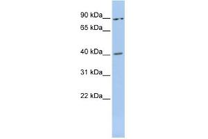 WB Suggested Anti-MEIS3 Antibody Titration:  0. (MEIS3 抗体  (Middle Region))