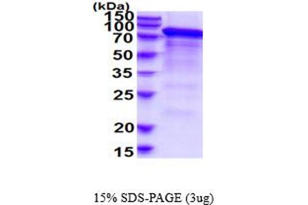 Integrin beta 2 Protein (ITGB2) (AA 23-700) (His tag)