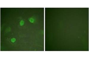 Immunofluorescence (IF) image for anti-GATA Binding Protein 3 (GATA3) (AA 274-323) antibody (ABIN2888838) (GATA3 抗体  (AA 274-323))