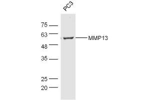 Western Blotting (WB) image for anti-Matrix Metallopeptidase 13 (Collagenase 3) (MMP13) (AA 201-300) antibody (ABIN670341)