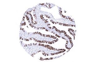 fallopian tube mucosa (Recombinant Cytokeratin 7 抗体  (AA 1-100))