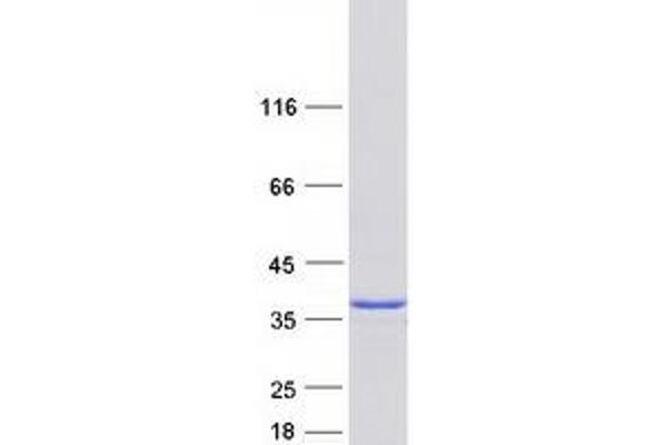 THTPA Protein (Transcript Variant 1) (Myc-DYKDDDDK Tag)