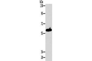 Gel: 8 % SDS-PAGE, Lysate: 40 μg, Lane: A549 cells, Primary antibody: ABIN7128549(ASB3 Antibody) at dilution 1/200, Secondary antibody: Goat anti rabbit IgG at 1/8000 dilution, Exposure time: 10 seconds (ASB3 抗体)