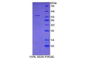 SDS-PAGE analysis of Human Topoisomerase I Protein. (Topoisomerase I 蛋白)