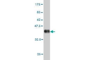 Western Blot detection against Immunogen (37. (GUCY2D 抗体  (AA 521-630))