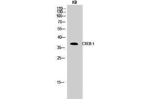 Western Blotting (WB) image for anti-cAMP Responsive Element Binding Protein 1 (CREB1) (Ser256) antibody (ABIN3174548) (CREB1 抗体  (Ser256))