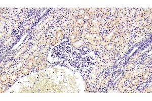 Detection of KMO in Human Kidney Tissue using Polyclonal Antibody to Kynurenine-3-Monooxygenase (KMO) (KMO 抗体  (AA 1-374))