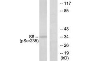 Western blot analysis of extracts from 293 cells treated with serum 10% 15', using S6 Ribosomal Protein (Phospho-Ser235) Antibody. (RPS6 抗体  (pSer235))