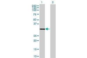 Lane 1: ZMAT2 transfected lysate ( 23. (ZMAT2 293T Cell Transient Overexpression Lysate(Denatured))