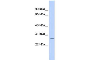 WB Suggested Anti-ZNF575 Antibody Titration:  0. (ZNF575 抗体  (Middle Region))