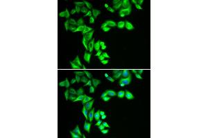 Immunofluorescence analysis of HeLa cells using STRN3 antibody. (STRN3 抗体)