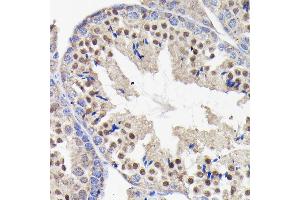 Immunohistochemistry of paraffin-embedded mouse testis using PI3 Kinase p85 beta Rabbit mAb (ABIN1679407, ABIN3019246, ABIN3019247 and ABIN7101736) at dilution of 1:100 (40x lens). (PIK3R2 抗体)