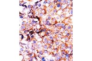 Image no. 2 for anti-Histone 3 (H3) (pSer10) antibody (ABIN358063) (Histone 3 抗体  (pSer10))