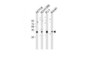 All lanes : Anti-VDAC2 Antibody (N-term) at 1:2000 dilution Lane 1: HC whole cell lysate Lane 2: NCI- whole cell lysate Lane 3: PC-3 whole cell lysate Lane 4: Mouse brain tissue lysate Lysates/proteins at 20 μg per lane. (VDAC2 抗体  (N-Term))